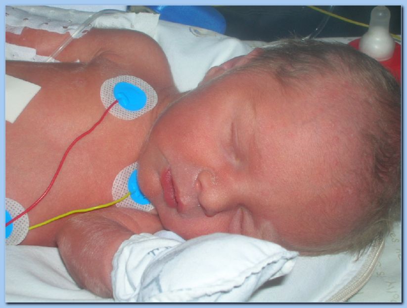 naissance corentin 067